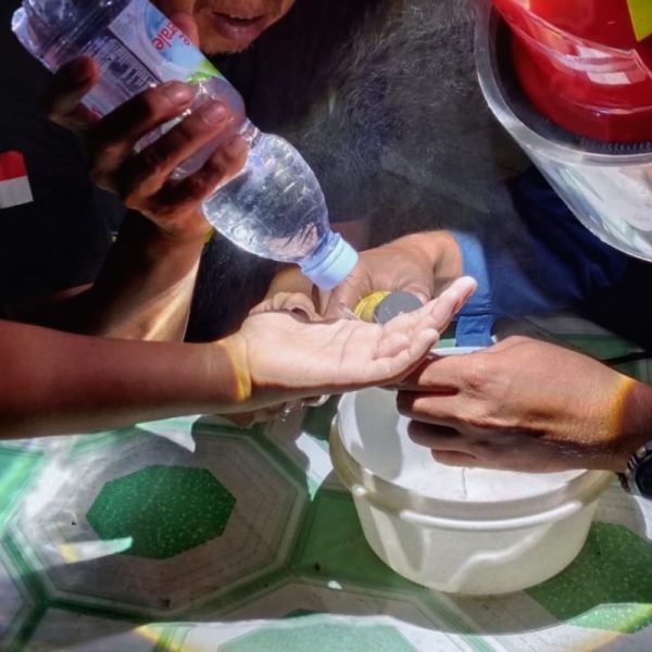 Damkar Ciamis Evakuasi Cincin Macet di Jari Pelajar dalam Empat Menit